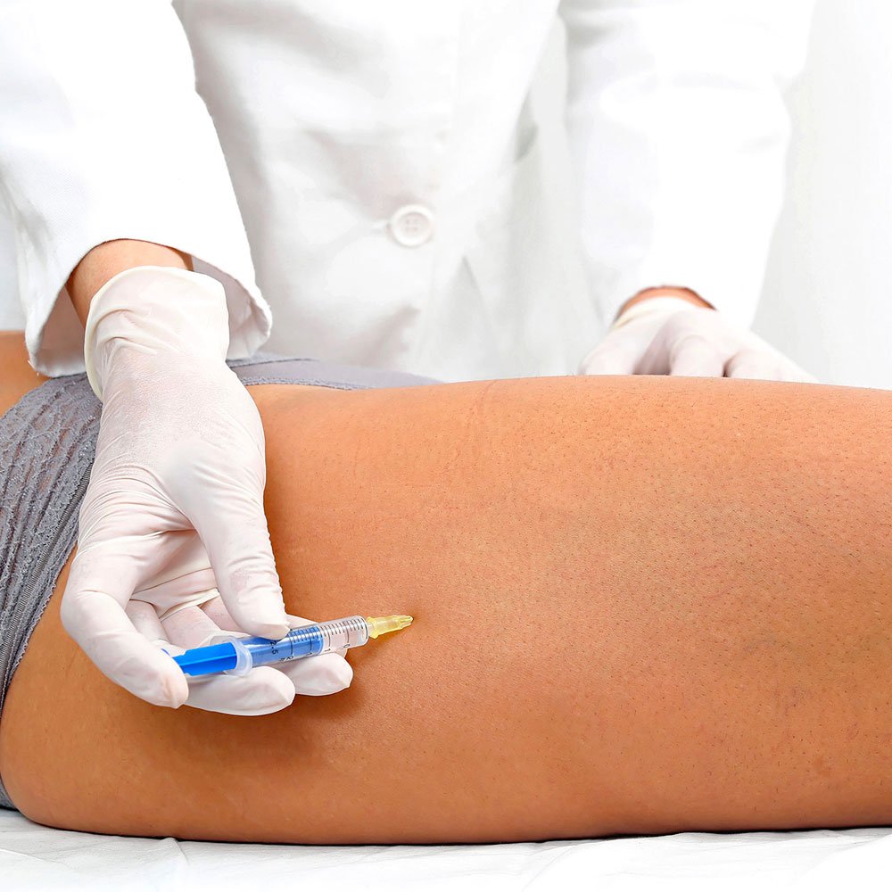 Mesoterapia